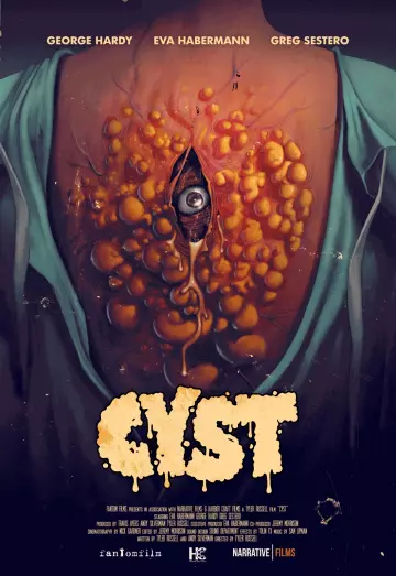 Cyst  [HDRIP] - FRENCH